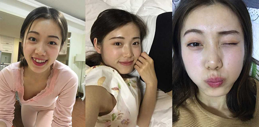 湖南❤️韩亚超❤️情侣私拍泄密 出轨怀孕奉子成婚 口交内射视频被绿帽男愤怒曝出！
